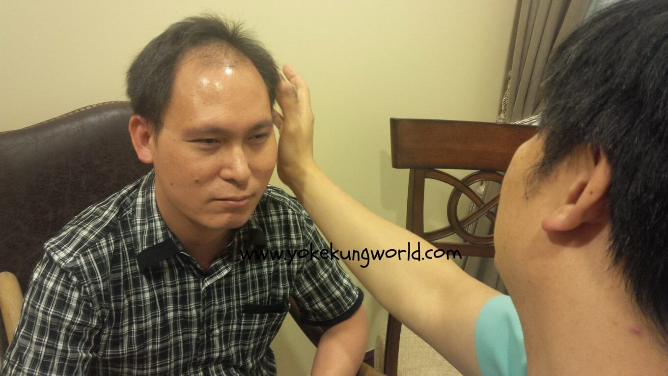 ผ่าวิกฤต พิชิตเส้นผม ตอนที่ 1 : สาเหตุของผมบาง